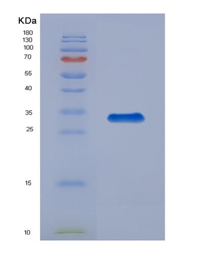 SDS-PAGE analysis of Human COPS6 (Cop9 Signalosome Complex Subunit 6) - Recombinant Protein, CAT# BLT-00666P, showing >90% purity under 15% SDS-PAGE (Reduced)Human COPS6 (Cop9 Signalosome Complex Subunit 6) - Recombinant Protein
