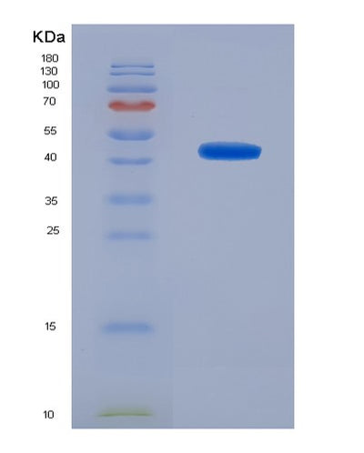 SDS-PAGE analysis of Human H2AC25 (Histone H2A Type 3) - Recombinant Protein, CAT# BLT-07105P, showing >90% purity under 15% SDS-PAGE (Reduced)Human H2AC25 (Histone H2A Type 3) - Recombinant Protein