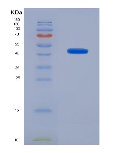SDS-PAGE analysis of Human H2AC25 (Histone H2A Type 3) - Recombinant Protein, CATHuman H2AC25 (Histone H2A Type 3) - Recombinant Protein