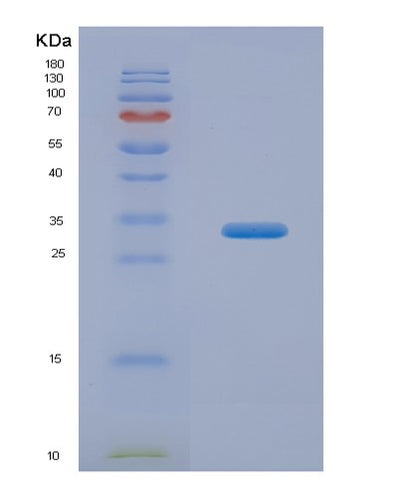 SDS-PAGE analysis of Human TP53 (Cellular Tumor Antigen P53) - Recombinant Protein, CAT# BLT-07732P, showing >90% purity under 15% SDS-PAGE (Reduced)Human TP53 (Cellular Tumor Antigen P53) - Recombinant Protein
