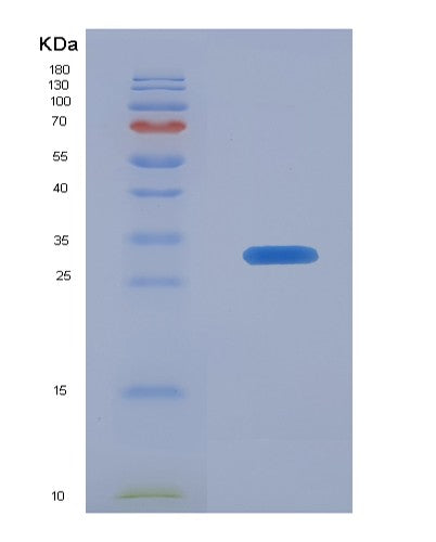 SDS-PAGE analysis of Human THBS2 (Thrombospondin-2) - Recombinant Protein, CATHuman THBS2 (Thrombospondin-2) - Recombinant Protein