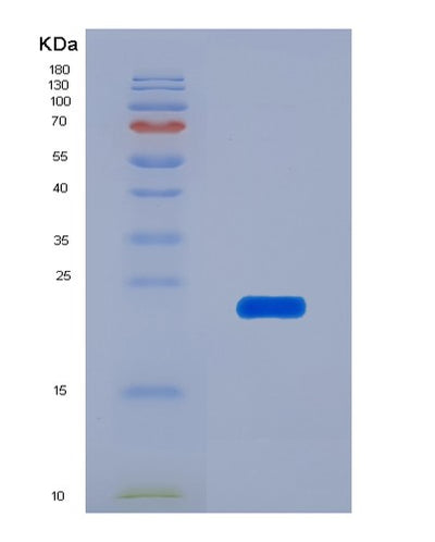 SDS-PAGE analysis of Human AFM (Afamin) - Recombinant Protein, CAT# BLT-07734P, showing >90% purity under 15% SDS-PAGE (Reduced)Human AFM (Afamin) - Recombinant Protein