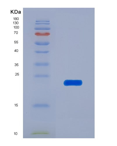 SDS-PAGE analysis of Human AFM (Afamin) - Recombinant Protein, CATHuman AFM (Afamin) - Recombinant Protein
