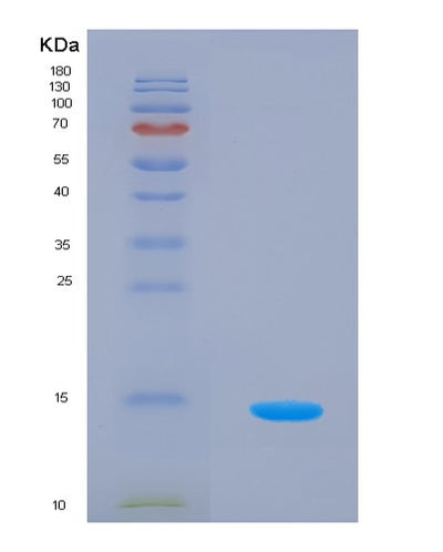 SDS-PAGE analysis of Human VTCN1 (V-Set Domain-Containing T-Cell Activation Inhibitor 1) - Recombinant Protein, CAT# BLT-03304P, showing >85% purity under 15% SDS-PAGE (Reduced)Human VTCN1 (V-Set Domain-Containing T-Cell Activation Inhibitor 1) - Recombinant Protein