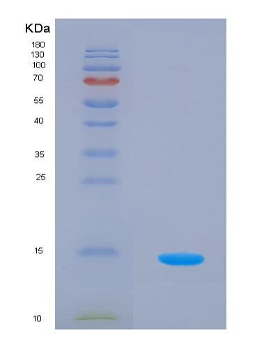 SDS-PAGE analysis of Human VTCN1 (V-Set Domain-Containing T-Cell Activation Inhibitor 1) - Recombinant Protein, CATHuman VTCN1 (V-Set Domain-Containing T-Cell Activation Inhibitor 1) - Recombinant Protein