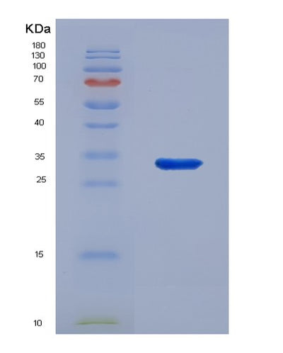 SDS-PAGE analysis of Human TICAM2 (Tir Domain-Containing Adapter Molecule 2) - Recombinant Protein, CAT# BLT-03041P, showing >95% purity under 15% SDS-PAGE (Reduced)Human TICAM2 (Tir Domain-Containing Adapter Molecule 2) - Recombinant Protein