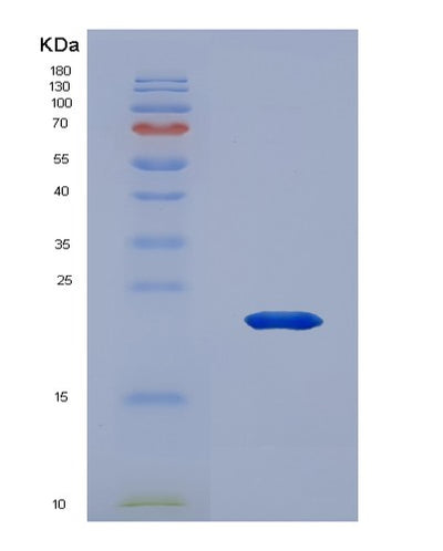 SDS-PAGE analysis of Human PDPN (Podoplanin) - Recombinant Protein, CAT# BLT-02196P, showing >95% purity under 15% SDS-PAGE (Reduced)Human PDPN (Podoplanin) - Recombinant Protein