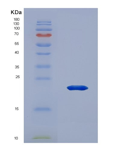 SDS-PAGE analysis of Human PDPN (Podoplanin) - Recombinant Protein, CATHuman PDPN (Podoplanin) - Recombinant Protein