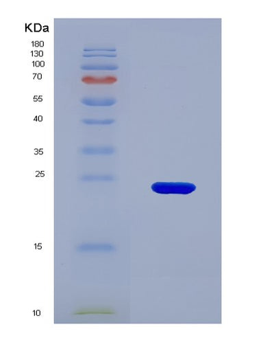 SDS-PAGE analysis of Human TPH2 (Tryptophan 5-Hydroxylase 2) - Recombinant Protein, CAT# BLT-04589P, showing >85% purity under 15% SDS-PAGE (Reduced)Human TPH2 (Tryptophan 5-Hydroxylase 2) - Recombinant Protein