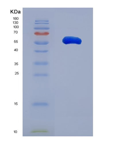 SDS-PAGE analysis of Human WWC1 (Protein Kibra) - Recombinant Protein, CAT# BLT-03318P, showing >85% purity under 15% SDS-PAGE (Reduced)Human WWC1 (Protein Kibra) - Recombinant Protein
