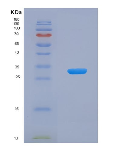 SDS-PAGE analysis of Human CA13 (Carbonic Anhydrase 13) - Recombinant Protein, CAT# BLT-00377P, showing >85% purity under 15% SDS-PAGE (Reduced)Human CA13 (Carbonic Anhydrase 13) - Recombinant Protein