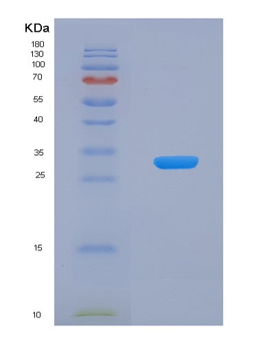 SDS-PAGE analysis of Human CA13 (Carbonic Anhydrase 13) - Recombinant Protein, CATHuman CA13 (Carbonic Anhydrase 13) - Recombinant Protein