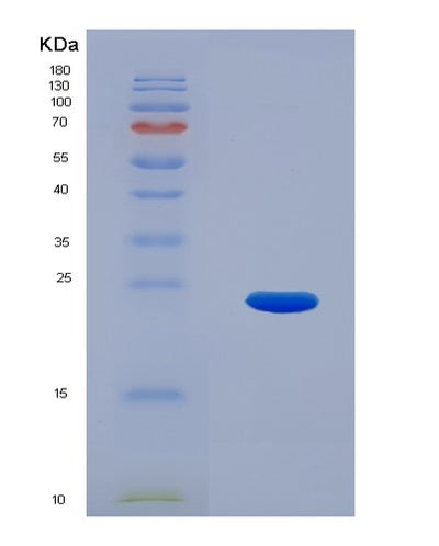 SDS-PAGE analysis of Human TRPV1 (Transient Receptor Potential Cation Channel Subfamily V Member 1) - Recombinant Protein, CAT# BLT-07159P, showing >95% purity under 15% SDS-PAGE (Reduced)Human TRPV1 (Transient Receptor Potential Cation Channel Subfamily V Member 1) - Recombinant Protein