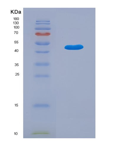 SDS-PAGE analysis of Human LPCAT1 (Lysophosphatidylcholine Acyltransferase 1) - Recombinant Protein, CAT# BLT-01734P, showing >95% purity under 15% SDS-PAGE (Reduced)Human LPCAT1 (Lysophosphatidylcholine Acyltransferase 1) - Recombinant Protein