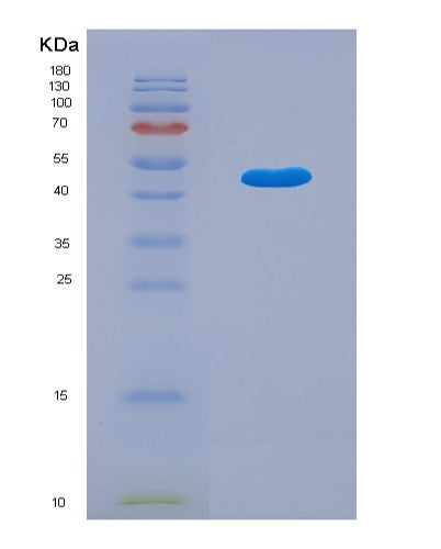 SDS-PAGE analysis of Human LPCAT1 (Lysophosphatidylcholine Acyltransferase 1) - Recombinant Protein, CATHuman LPCAT1 (Lysophosphatidylcholine Acyltransferase 1) - Recombinant Protein