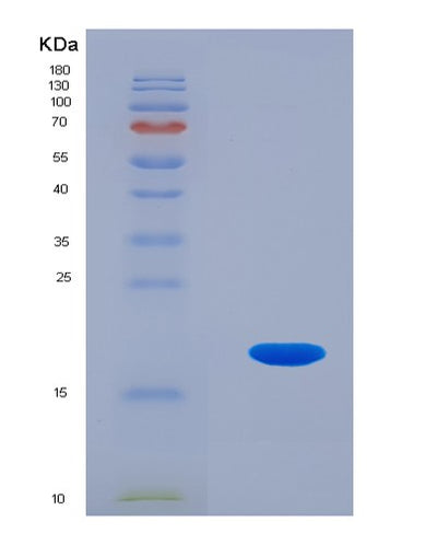 SDS-PAGE analysis of Human PFN4 (Profilin-4) - Recombinant Protein, CAT# BLT-02387P, showing >90% purity under 15% SDS-PAGE (Reduced)Human PFN4 (Profilin-4) - Recombinant Protein