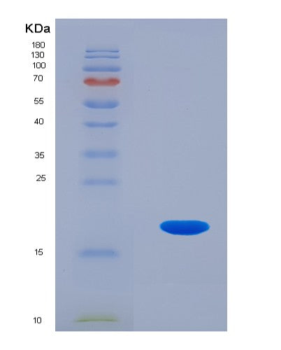 SDS-PAGE analysis of Human PFN4 (Profilin-4) - Recombinant Protein, CATHuman PFN4 (Profilin-4) - Recombinant Protein