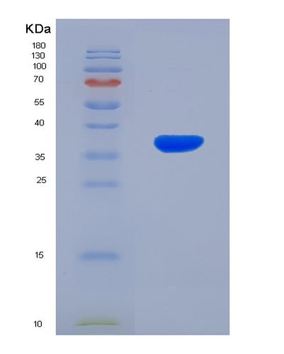 SDS-PAGE analysis of Human CCL4L1 (C-C Motif Chemokine 4-Like) - Recombinant Protein, CAT# BLT-00452P, showing >90% purity under 15% SDS-PAGE (Reduced)Human CCL4L1 (C-C Motif Chemokine 4-Like) - Recombinant Protein
