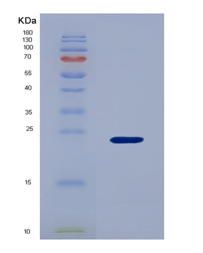 SDS-PAGE analysis of Mouse Blmh (Bleomycin Hydrolase) - Recombinant Protein, CAT# BLT-05873P, showing >95% purity under 15% SDS-PAGE (Reduced)Mouse Blmh (Bleomycin Hydrolase) - Recombinant Protein
