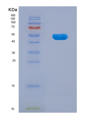 SDS-PAGE analysis of Human TNNT2 (Troponin T, Cardiac Muscle) - Recombinant Protein, CAT# BLT-07735P, showing >90% purity under 15% SDS-PAGE (Reduced)Human TNNT2 (Troponin T, Cardiac Muscle) - Recombinant Protein