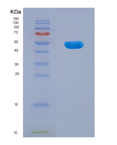 SDS-PAGE analysis of Human TNNT2 (Troponin T, Cardiac Muscle) - Recombinant Protein, CATHuman TNNT2 (Troponin T, Cardiac Muscle) - Recombinant Protein