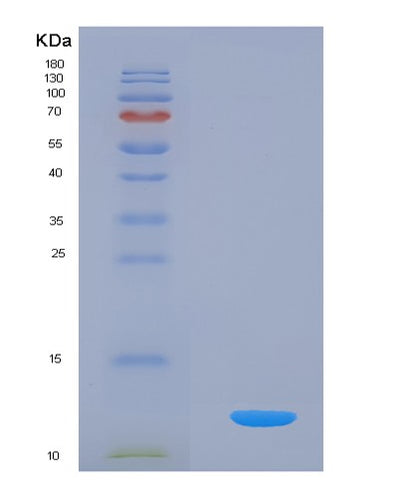 SDS-PAGE analysis of Human GPT2 (Alanine Aminotransferase 2) - Recombinant Protein, CAT# BLT-01267P, showing >95% purity under 15% SDS-PAGE (Reduced)Human GPT2 (Alanine Aminotransferase 2) - Recombinant Protein