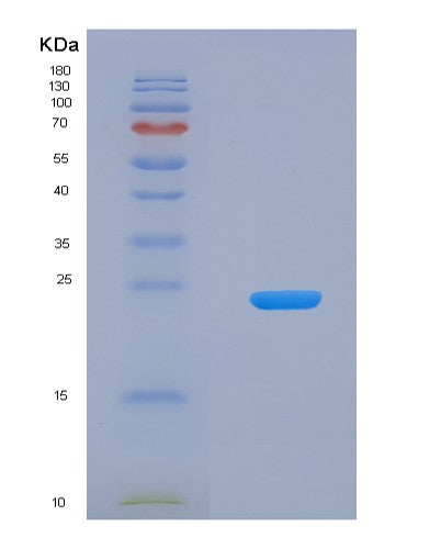 SDS-PAGE analysis of Human HAVCR2 (Hepatitis A Virus Cellular Receptor 2) - Recombinant Protein, CATHuman HAVCR2 (Hepatitis A Virus Cellular Receptor 2) - Recombinant Protein