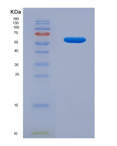 SDS-PAGE analysis of Human TCP1 (T-Complex Protein 1 Subunit Alpha) - Recombinant Protein, CAT# BLT-03000P, showing >85% purity under 15% SDS-PAGE (Reduced)Human TCP1 (T-Complex Protein 1 Subunit Alpha) - Recombinant Protein
