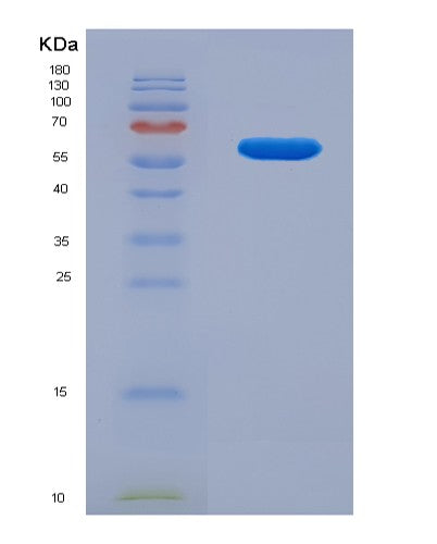 SDS-PAGE analysis of Human TCP1 (T-Complex Protein 1 Subunit Alpha) - Recombinant Protein, CATHuman TCP1 (T-Complex Protein 1 Subunit Alpha) - Recombinant Protein