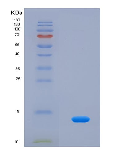 SDS-PAGE analysis of Human DEFB104A (Beta-Defensin 104) - Recombinant Protein, CAT# BLT-04262P, showing >95% purity under 15% SDS-PAGE (Reduced)Human DEFB104A (Beta-Defensin 104) - Recombinant Protein