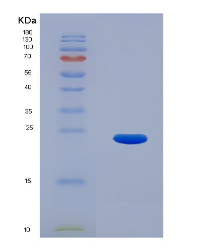 SDS-PAGE analysis of Mouse Crygs (Gamma-Crystallin S) - Recombinant Protein, CATMouse Crygs (Gamma-Crystallin S) - Recombinant Protein