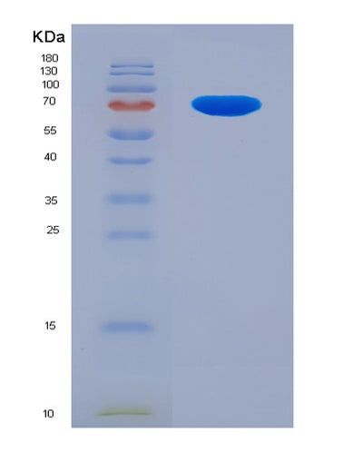 SDS-PAGE analysis of Human USP9X (Ubiquitin Carboxyl-Terminal Hydrolase 9X) - Recombinant Protein, CAT# BLT-07739P, showing >90% purity under 15% SDS-PAGE (Reduced)Human USP9X (Ubiquitin Carboxyl-Terminal Hydrolase 9X) - Recombinant Protein