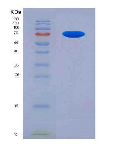 SDS-PAGE analysis of Human USP9X (Ubiquitin Carboxyl-Terminal Hydrolase 9X) - Recombinant Protein, CATHuman USP9X (Ubiquitin Carboxyl-Terminal Hydrolase 9X) - Recombinant Protein
