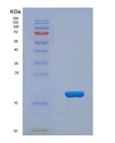 SDS-PAGE analysis of Human PTPMT1 (Phosphatidylglycerophosphatase And Protein-Tyrosine Phosphatase 1) - Recombinant Protein, CAT# BLT-02445P, showing >95% purity under 15% SDS-PAGE (Reduced)Human PTPMT1 (Phosphatidylglycerophosphatase And Protein-Tyrosine Phosphatase 1) - Recombinant Protein