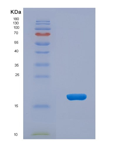 SDS-PAGE analysis of Human PTPMT1 (Phosphatidylglycerophosphatase And Protein-Tyrosine Phosphatase 1) - Recombinant Protein, CATHuman PTPMT1 (Phosphatidylglycerophosphatase And Protein-Tyrosine Phosphatase 1) - Recombinant Protein