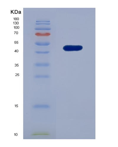 SDS-PAGE analysis of Human PDCD6IP (Programmed Cell Death 6-Interacting Protein) - Recombinant Protein, CAT# BLT-00132P, showing >90% purity under 15% SDS-PAGE (Reduced)Human PDCD6IP (Programmed Cell Death 6-Interacting Protein) - Recombinant Protein