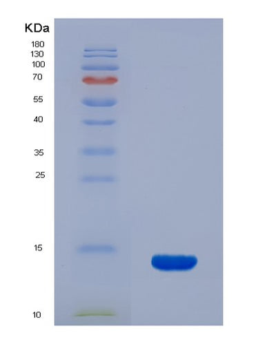 SDS-PAGE analysis of Human SLC1A1 (Excitatory Amino Acid Transporter 3) - Recombinant Protein, CAT# BLT-07741P, showing >90% purity under 15% SDS-PAGE (Reduced)Human SLC1A1 (Excitatory Amino Acid Transporter 3) - Recombinant Protein