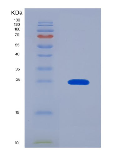 SDS-PAGE analysis of Human CYGB (Cytoglobin) - Recombinant Protein, CAT# BLT-04145P, showing >95% purity under 15% SDS-PAGE (Reduced)Human CYGB (Cytoglobin) - Recombinant Protein