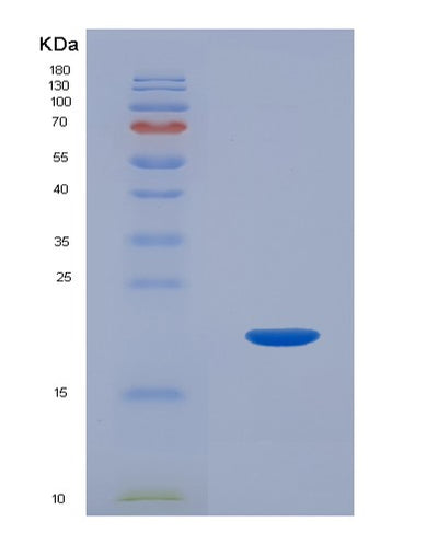 SDS-PAGE analysis of Human IL1F10 (Interleukin-1 Family Member 10) - Recombinant Protein, CAT# BLT-01532P, showing >95% purity under 15% SDS-PAGE (Reduced)Human IL1F10 (Interleukin-1 Family Member 10) - Recombinant Protein