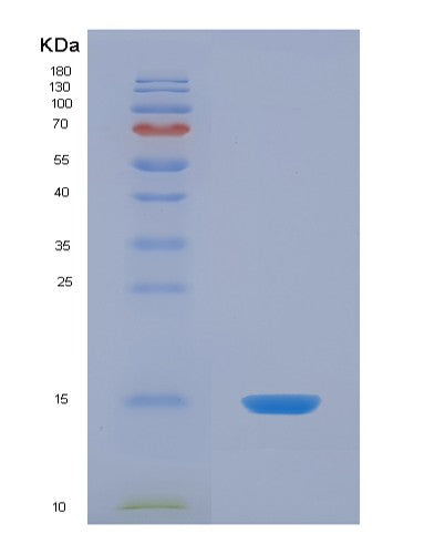 SDS-PAGE analysis of Human S100Z (Protein S100-Z) - Recombinant Protein, CATHuman S100Z (Protein S100-Z) - Recombinant Protein