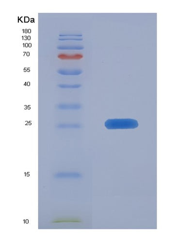 SDS-PAGE analysis of Human FAM3C (Protein Fam3C) - Recombinant Protein, CAT# BLT-01045P, showing >95% purity under 15% SDS-PAGE (Reduced)Human FAM3C (Protein Fam3C) - Recombinant Protein