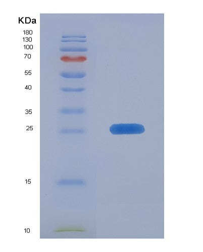 SDS-PAGE analysis of Human FAM3C (Protein Fam3C) - Recombinant Protein, CATHuman FAM3C (Protein Fam3C) - Recombinant Protein