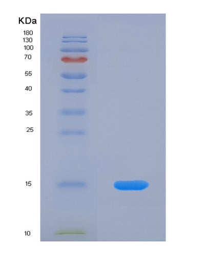 SDS-PAGE analysis of Human HSPH1 (Heat Shock Protein 105 Kda) - Recombinant Protein, CAT# BLT-01435P, showing >90% purity under 15% SDS-PAGE (Reduced)Human HSPH1 (Heat Shock Protein 105 Kda) - Recombinant Protein