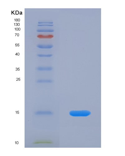SDS-PAGE analysis of Human HSPH1 (Heat Shock Protein 105 Kda) - Recombinant Protein, CATHuman HSPH1 (Heat Shock Protein 105 Kda) - Recombinant Protein