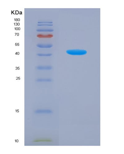 SDS-PAGE analysis of Human SLC2A4 (Solute Carrier Family 2, Facilitated Glucose Transporter Member 4) - Recombinant Protein, CAT# BLT-07742P, showing >90% purity under 15% SDS-PAGE (Reduced)Human SLC2A4 (Solute Carrier Family 2, Facilitated Glucose Transporter Member 4) - Recombinant Protein