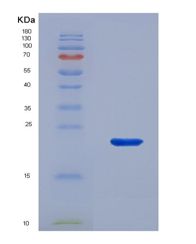 SDS-PAGE analysis of Human THRSP (Thyroid Hormone-Inducible Hepatic Protein) - Recombinant Protein, CATHuman THRSP (Thyroid Hormone-Inducible Hepatic Protein) - Recombinant Protein