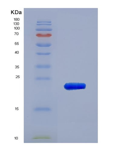SDS-PAGE analysis of Human BCL2L2 (Bcl-2-Like Protein 2) - Recombinant Protein, CAT# BLT-00304P, showing >90% purity under 15% SDS-PAGE (Reduced)Human BCL2L2 (Bcl-2-Like Protein 2) - Recombinant Protein