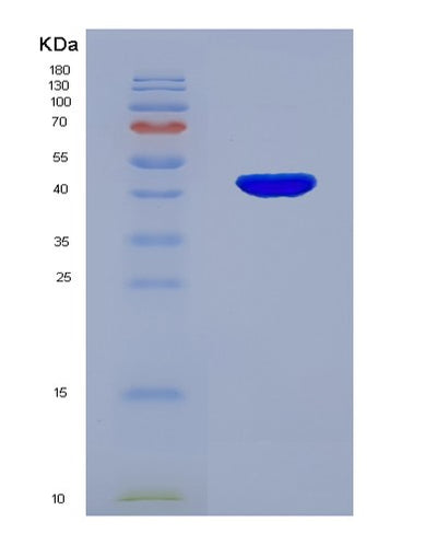 SDS-PAGE analysis of Human GPX4 (Phospholipid Hydroperoxide Glutathione Peroxidase Gpx4) - Recombinant Protein, CAT# BLT-07743P, showing >90% purity under 15% SDS-PAGE (Reduced)Human GPX4 (Phospholipid Hydroperoxide Glutathione Peroxidase Gpx4) - Recombinant Protein
