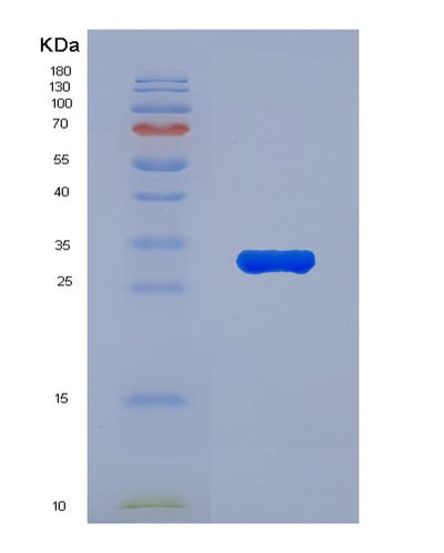SDS-PAGE analysis of Human CASP10 (Caspase-10) - Recombinant Protein, CAT# BLT-04913P, showing >85% purity under 15% SDS-PAGE (Reduced)Human CASP10 (Caspase-10) - Recombinant Protein
