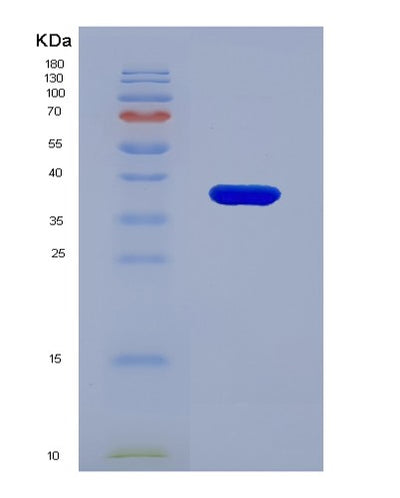 SDS-PAGE analysis of Human PMM1 (Phosphomannomutase 1) - Recombinant Protein, CAT# BLT-02298P, showing >95% purity under 15% SDS-PAGE (Reduced)Human PMM1 (Phosphomannomutase 1) - Recombinant Protein